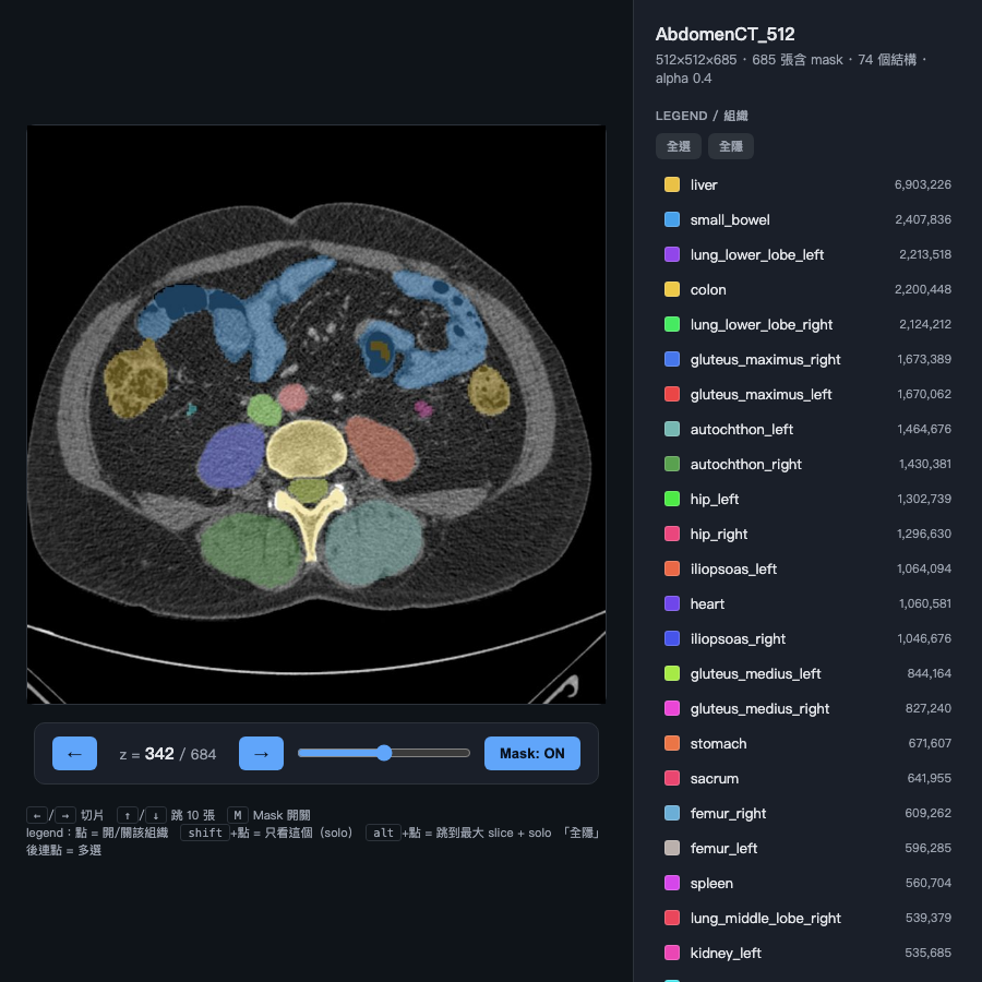 CT slice with anatomical mask overlays