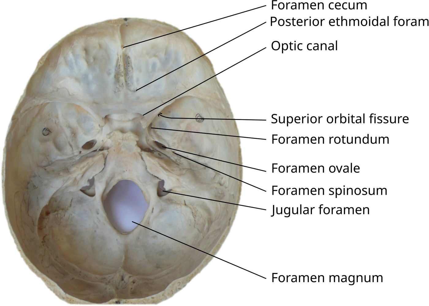 人類顱底內面實物照片，標示 optic canal、superior orbital fissure、rotundum、ovale、jugular foramen 等通道